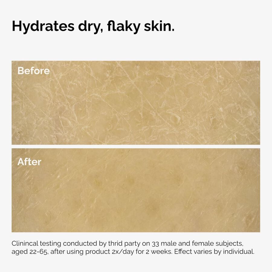 the-body-care-collection-n4 ord-natural-moisturizing-factors-inulin-body-before-after-graphic-02.jpg