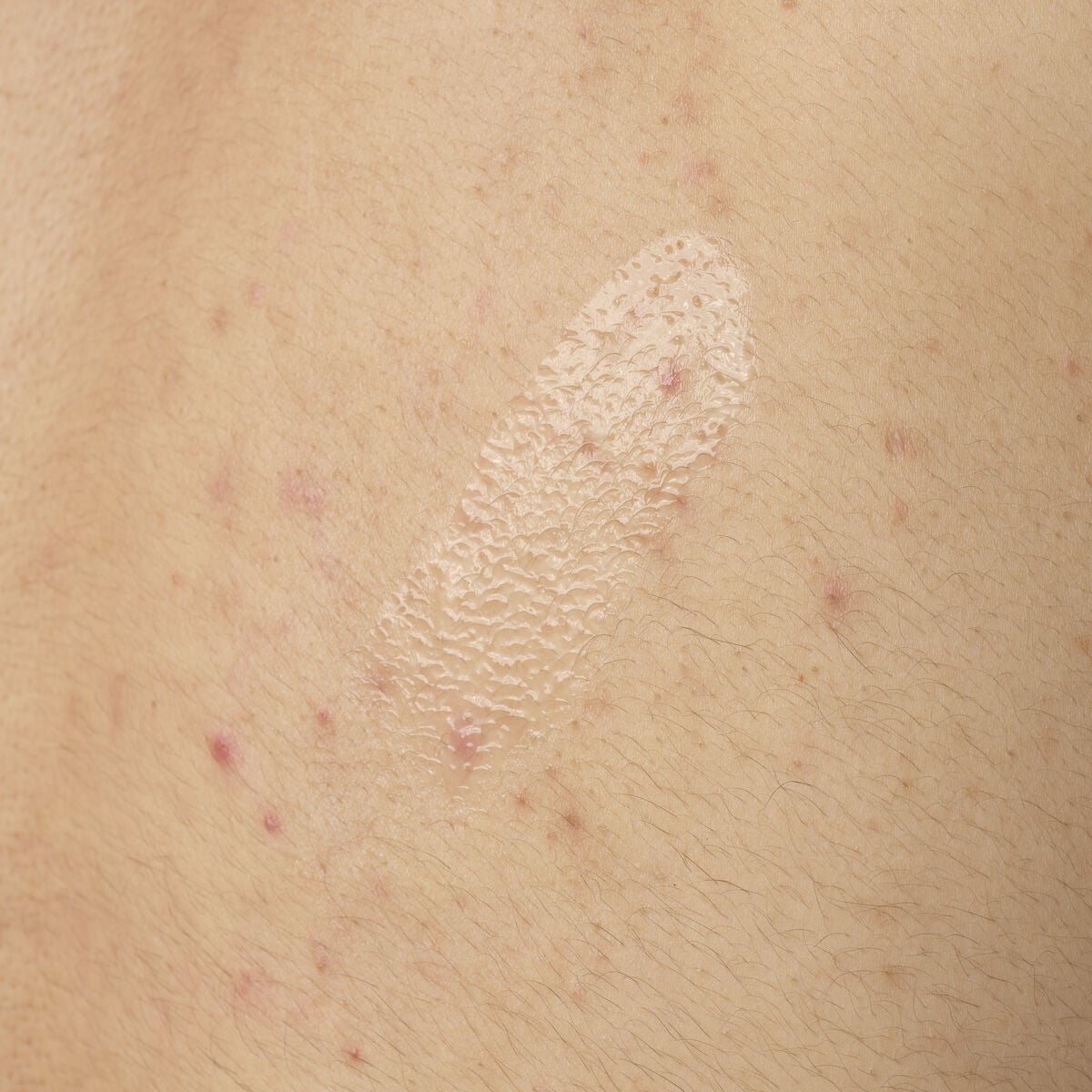 salicylic-acid-0-5-body-serum-t4 ORD-salicylic-acid-05-body-240ml-application.jpg