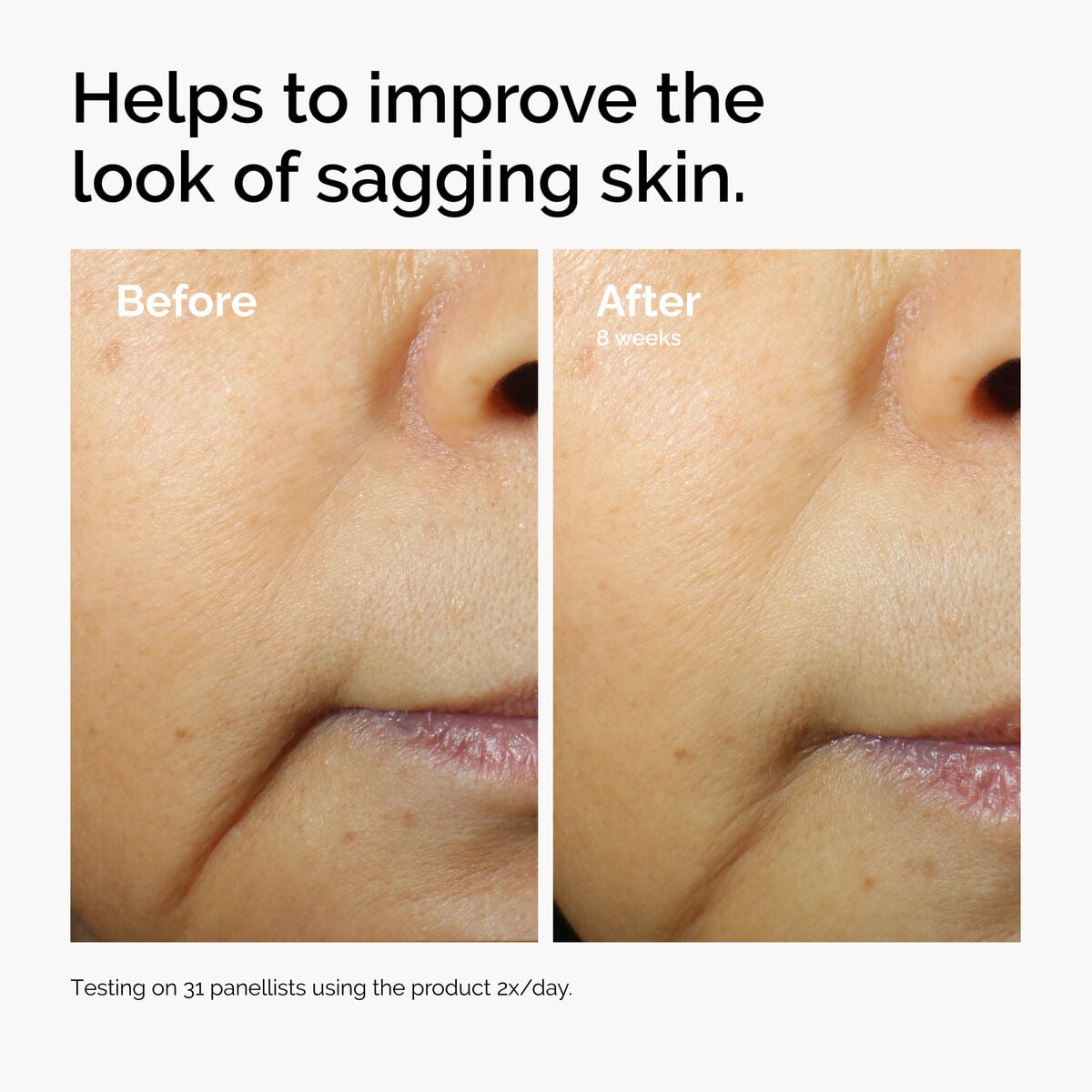 caffeine-3-escin-1-face-serum-p6 ord-caffeine-3pct-escin-1pct-face-serum-before-after-sagging.jpg