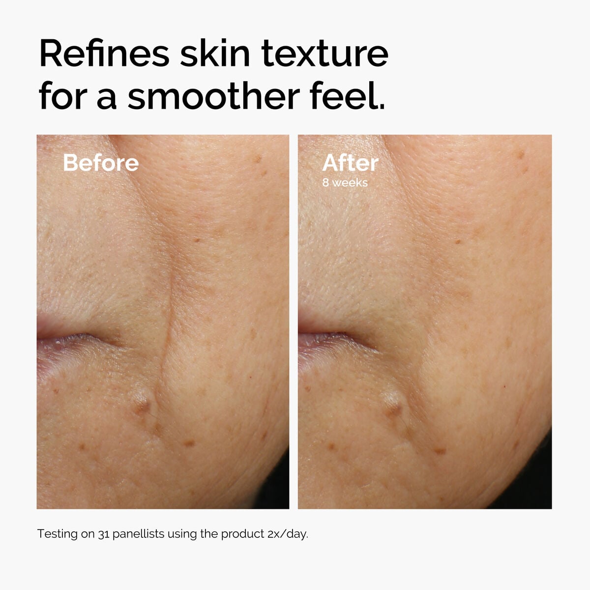 caffeine-3-escin-1-face-serum-p6 ord-caffeine-3pct-escin-1pct-face-serum-before-after-texture.jpg