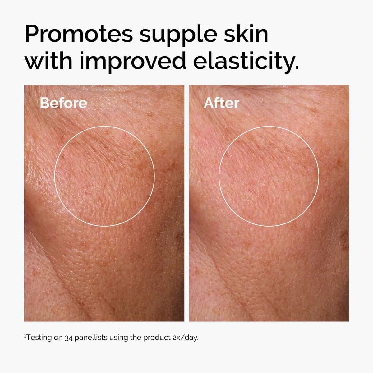 hyaluronic-acid-2-b5-with-ceramides-p2 ord-hyaluronic-acid-2pct-b5-hydrating-serum-before-after-elasticity.jpg