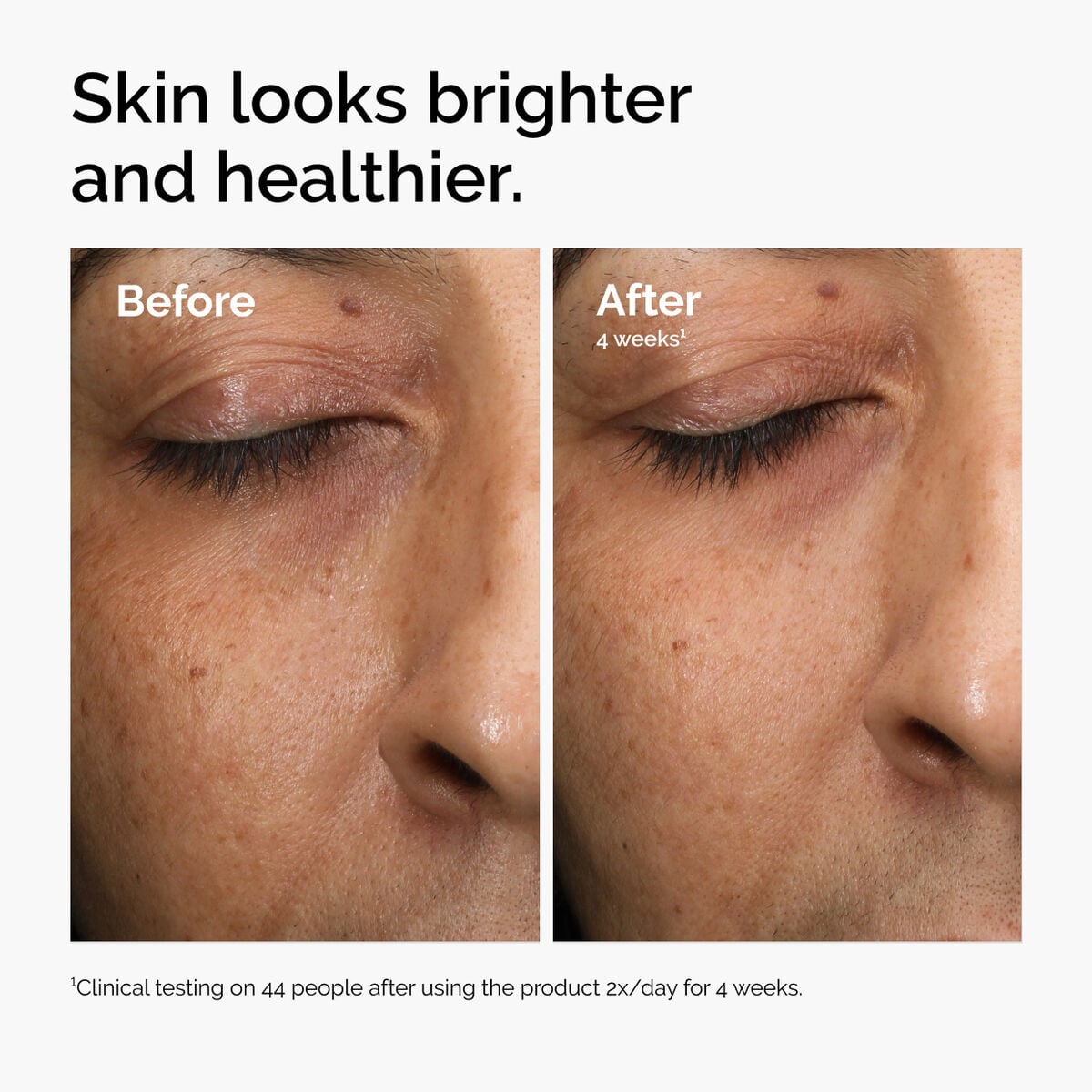 multi-antioxidant-radiance-serum-b0 ord-mars-before-after-healthy.jpg