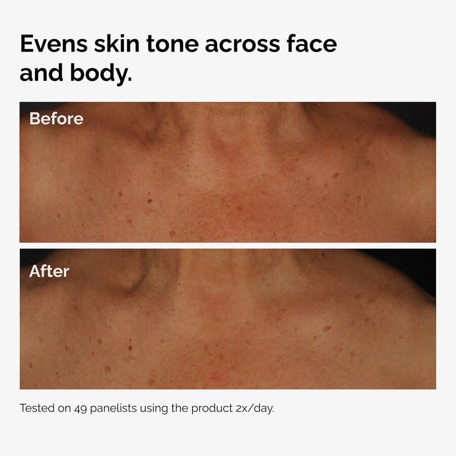 the-body-care-collection-n4 ord-niacinamide-face-body-serum-before-after-even-tone-graphic.jpg