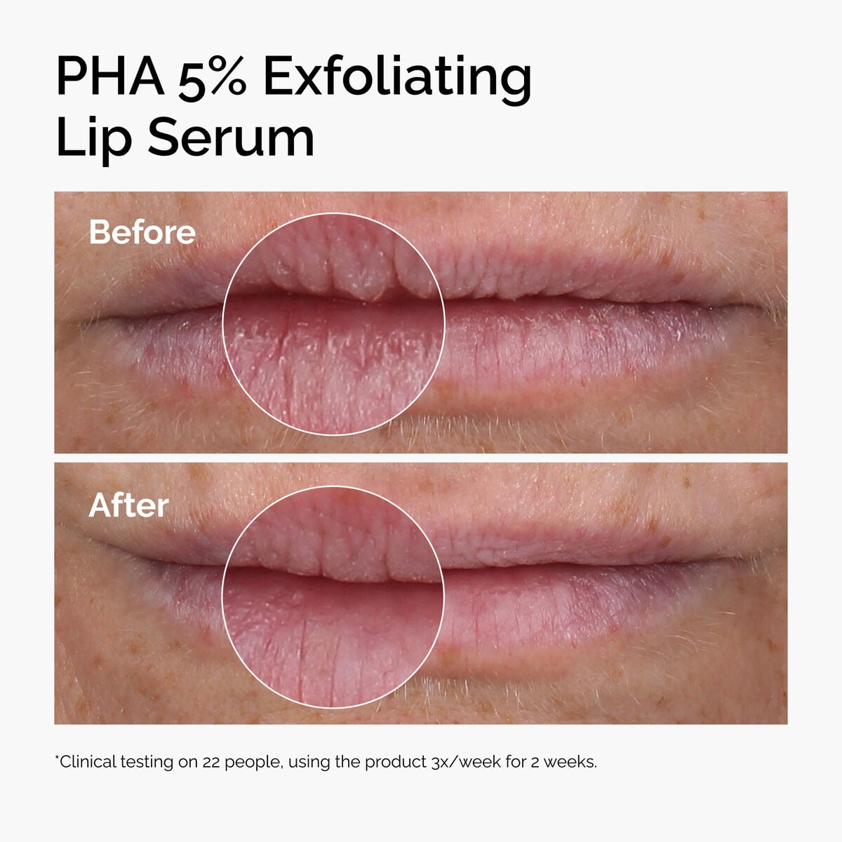 pha-5-exfoliating-lip-serum-n1 ord-pha-5pct-lip-exfoliating-serum-before-after.jpg